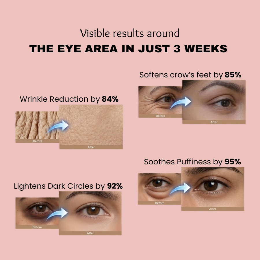 Under Eye Roller Cream-For Under Eye and Dark Circle Cream for Eyes